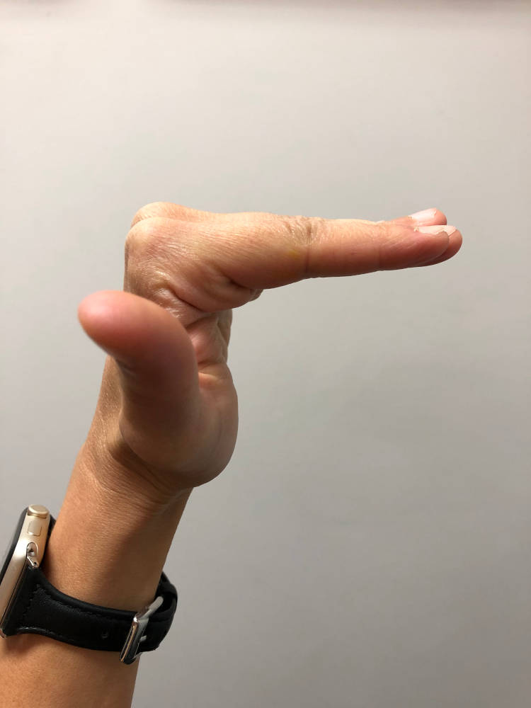 Tendon Gliding Exercises (Hand) Zen Physiotherapy