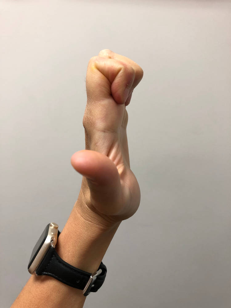 Tendon Gliding Exercises (Hand) Zen Physiotherapy